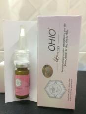 OHIO NEW DAY – Serum Nám, Giữ ẩm, Xóa tàn nhang, Se khít lỗ chân lông, Ngừa lão hóa (10ml)