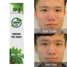 Neem Oil – Serum đặc trị mụn