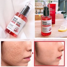Serum Ốc Sên Snail Loại Bỏ Sẹo Mụn, Dưỡng Phục Hồi, Cải Thiện Vết Thâm