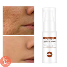 VIBRANT GLAMOUR Serum Phục Hồi Da Sẹo Rỗ Làm Mờ Vết Thâm Loại Bỏ Sẹo Kiềm Dầu VG Skin Care Scar Treatment Repair Toner Serum
