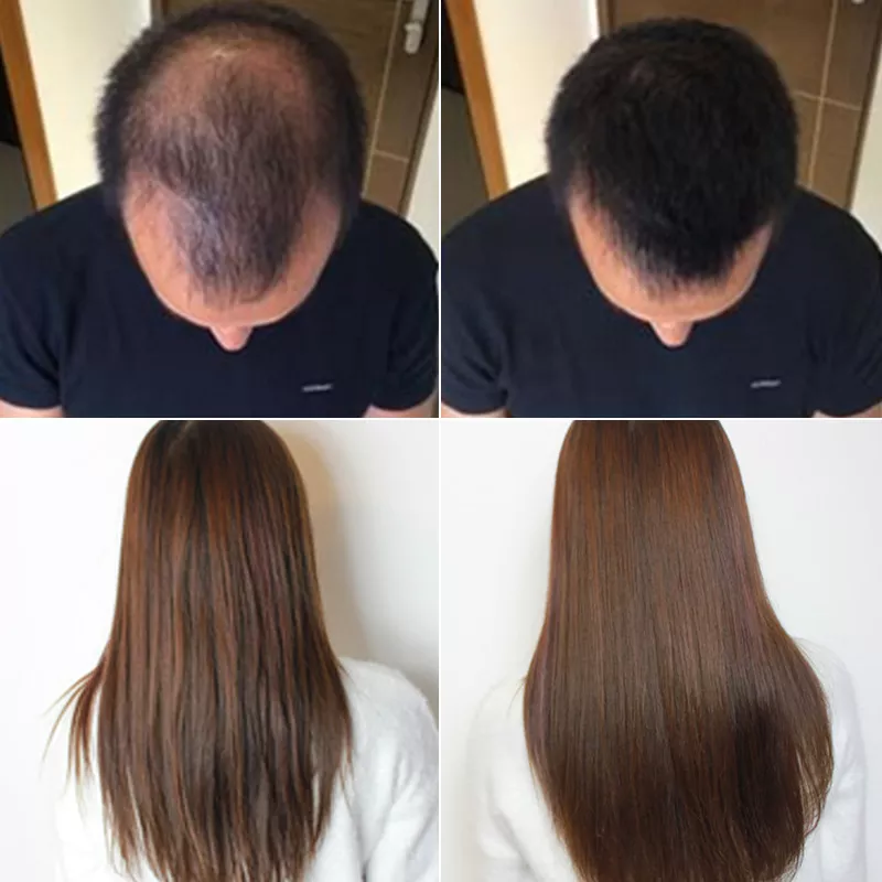 Dầu gội chống rụng giúp mọc tóc 500ml Gừng có tác dụng làm mọc tóc, dày tóc dưỡng tóc chắc...