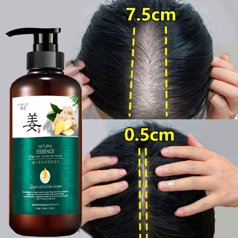 Dầu gội chống rụng giúp mọc tóc 500ml Gừng có tác dụng làm mọc tóc, dày tóc dưỡng tóc chắc...
