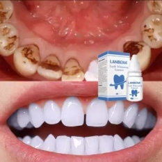 LANBENA TRẮNG RĂNG Teeth Clean Spot Cleaning LÀM SẠCH RĂNG Teeth Whitening TRẮNG RĂNG Teeth White Intensive Whitening Treatment