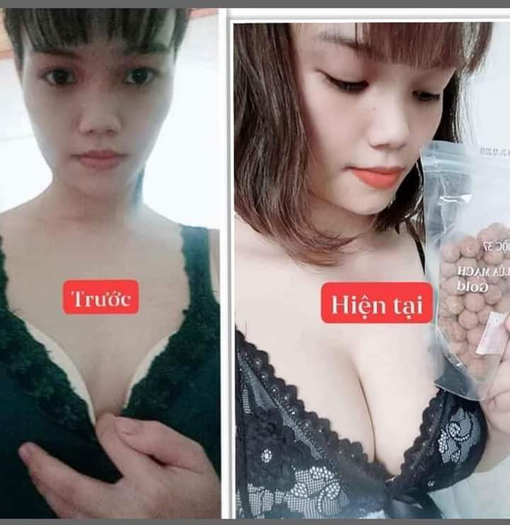 ( Mua 4 hộp tặng 1 hộp + dây đo ) Kẹo mầm kích thích vòng 1 to, săn chắc,đầy...