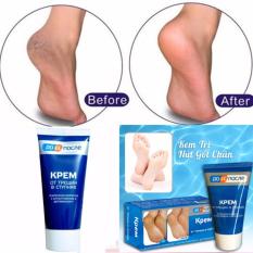 Kem Trị Nứt Gót Chân Thần Thánh KPEM-Nga 50ml