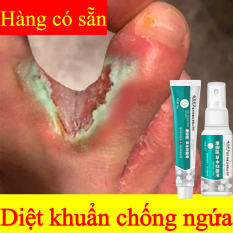 Xịt khử mùi hôi chân, Kem khử mùi hôi chân Tinh chất khử mùi thảo dược 35g tinh chất thảo dược có tác dụng ức chế vi khuẩn, loại bỏ mồ hôi chân và mùi hôi chân nước ăn chân, không gây hại cho da ngăn ngừa hôi chân chống nấm chân