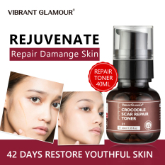 VIBRANT GLAMOUR 40ml Serum Dưỡng Phục Hồi Cải Thiện Vết Thâm Sẹo Lõm Phục Hồi Da Sẹo Rỗ Làm Mờ Vết Thâm Loại Bỏ Sẹo Thu Nhỏ Lỗ Chân Lông Làm Sáng Mịn Chăm Sóc Da Nhạy Cảm – INTL