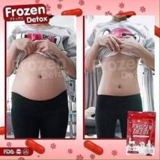 VIÊN KHỬ MỠ GIẢM CÂN FRONZEN DETOX THÁI LAN