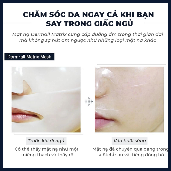 Mặt nạ Derm all Matrix collagen dưỡng trắng da, căng da, chống lão hóa - 1 HỘP 4 MIẾNG [K2V...